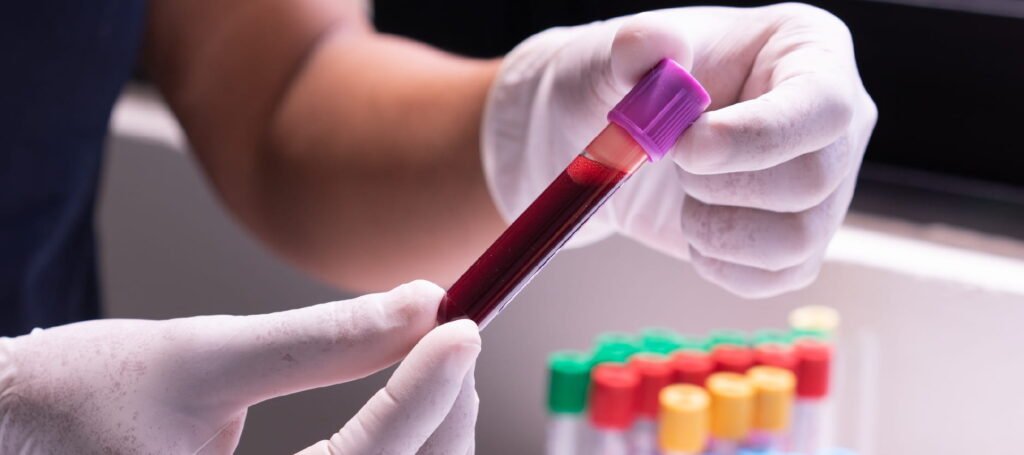 Blood Test Analysis and Its Importance for Health